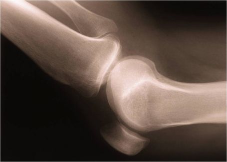 Van de verzorgers: Kijkoperatie knie